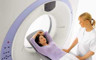 Магнитно-резонансная томография головного мозга: как проходит исследование, результаты