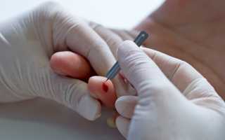 Причины отклонения от нормы содержания тромбоцитов в крови у женщин