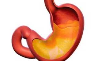 Пониженная кислотность желудка: симптомы и лечение, как диагностируется