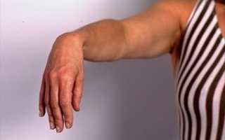На руке дергается мышца: причины и лечение болезней, проявляющихся этим симптомом