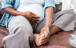 Чем опасен ожог при беременности и что делать?