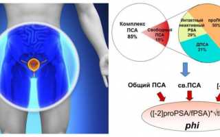 Свободный и общий анализ ПСА у мужчин: расшифровка по возрасту