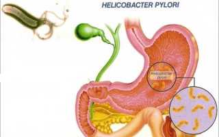 Хеликобактерный гастрит: у кого и как возникает, как проявляется и лечится