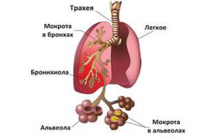 Пневмония – это самостоятельное заболевание или осложнение гриппа?