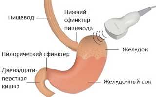 Что показывает и как делают узи желудка