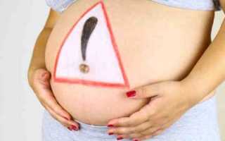 Болит желудок при беременности: что делать и чем лечить, рецепты народной медицины