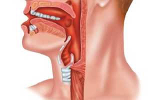Лейкоплакия слизистой оболочки кишечника — причины и лечение