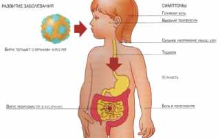 Почему болит живот при ротовирусе у ребенка и взрослого