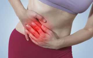 Симптомы и лечение эндометриоза кишечника