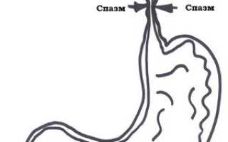 Спазм пищевода: с чем связано возникновение такого состояния и как его снимать