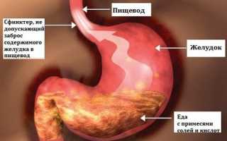 Хронический рефлюкс-гастрит: что вызывает, проявления и методы лечения