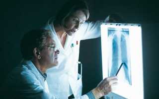 Рентгеноскопия и рентгенография желудка с барием: показания к применению контраста