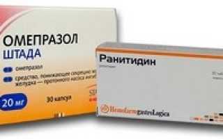 Ранитидин или Омепразол: что лучше и каковы отличия, можно ли принимать одновременно