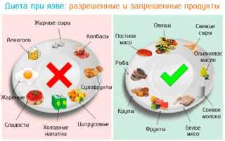 Рекомендуемые и запрещенные продукты при язве желудка