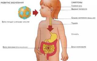 Почему у детей возникает кишечная инфекция, способы ее лечения