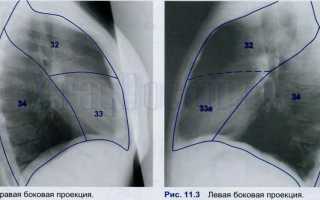 Топография и сегменты легких на рентгенограмме