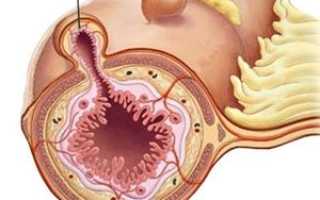 Непроходимость пищевода: какими причинами вызвана и как ее устранить