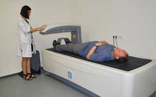 Что такое рентгеновская денситометрия, как проводится и для чего назначается?