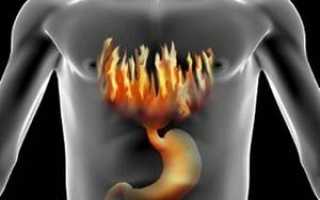Заброс кислоты из желудка в пищевод: чем вызван, и как его устранить